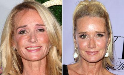 //kim richards nose job