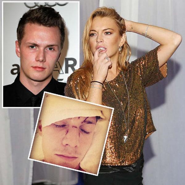 Barron Hilton 25 Of The Biggest Scandals To Hit Lindsay Lohan