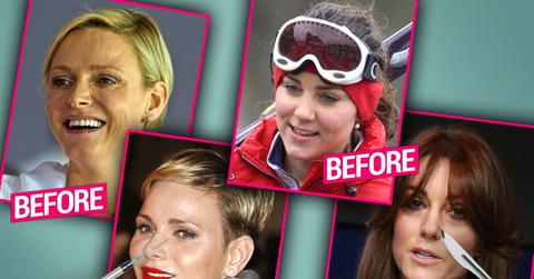 royal plastic surgery secrets