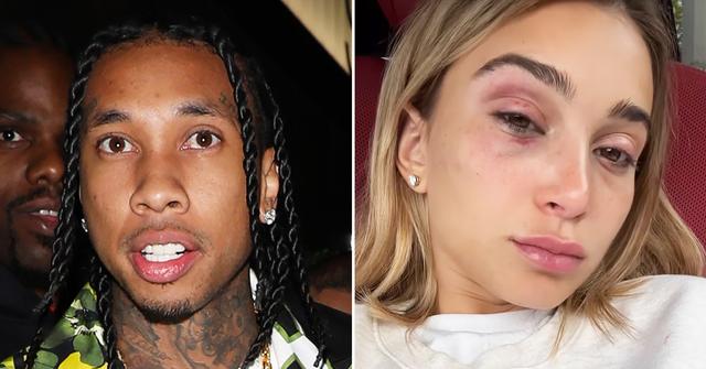 tyga arrives police station questions alleged assault ex girlfriend camaryn swanson black eye r