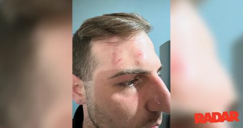 kyle chrisley victim photos