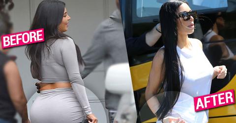 Kim Kardashian Butt Implants Plastic Surgery Claims