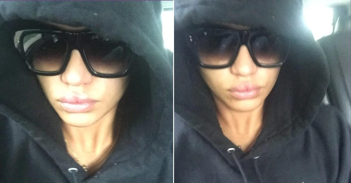 cassie ventura busted lip split pic sdny