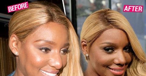 nene leakes nose job plastic surgery RHOA Exposed Photos