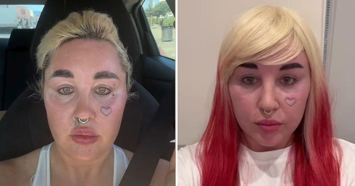 amanda bynes stunning new look lip fillers ozempic weight loss journey
