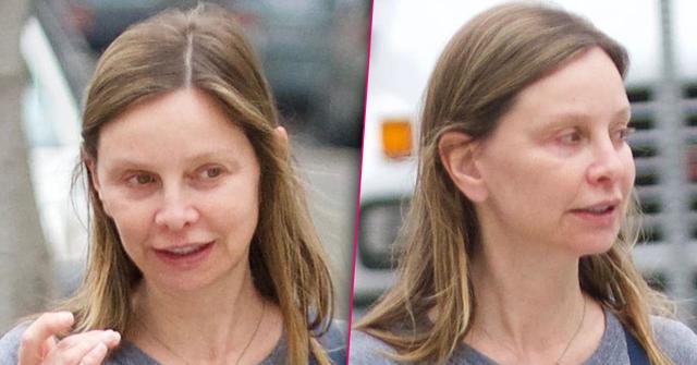 //calista flockhart plastic surgery before after pp