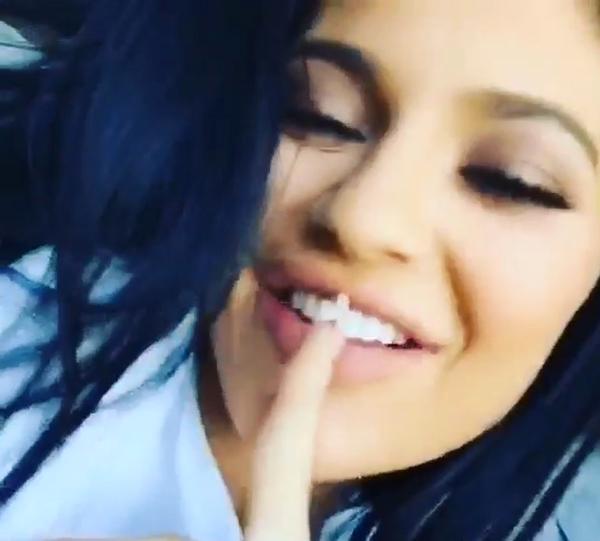 //Kylie Jenner Caught Another Plastic Surgery Lie Photos