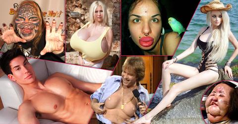 // worst plastic surgeries_
