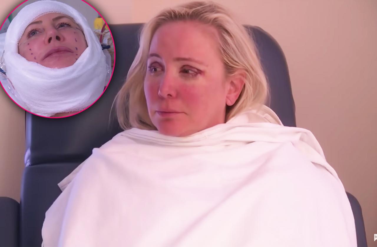 RHOC Star Shannon Beador Undergoes Plastic Surgery Makeover