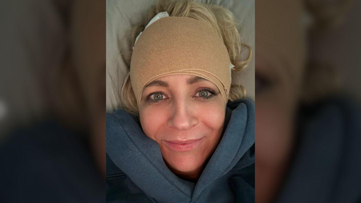 image of Bickmore shared graphic images of the deep head wound and bandages on Instagram.