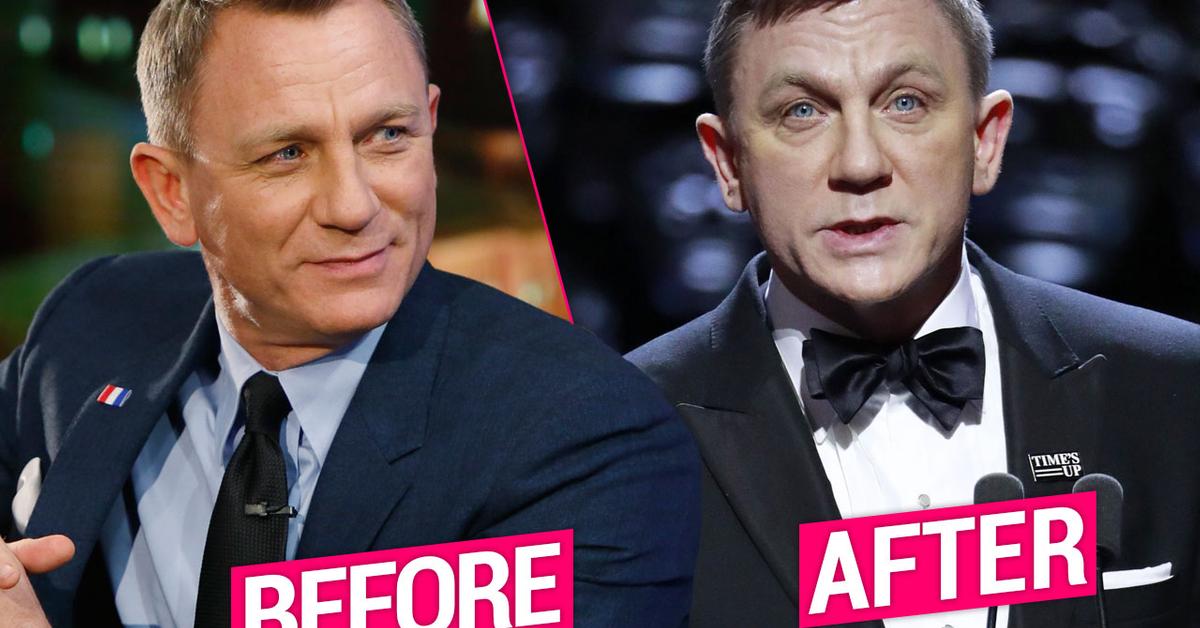 Daniel Craig Flaunts Freaky New Face After Plastic Surgery Disaster