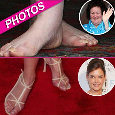 More Imperfections Of The Rich & Famous! 10 Stars With Not-So-Fabulous Feet