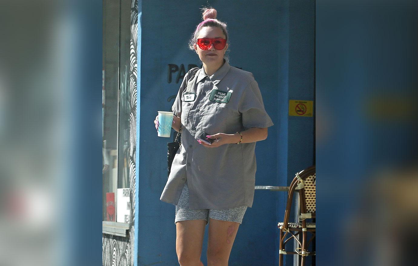 Amanda Bynes Spotted With Large Bruise During Lone Date Following Rehab