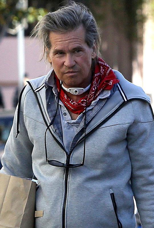 Val Kilmer Tracheostomy Photo