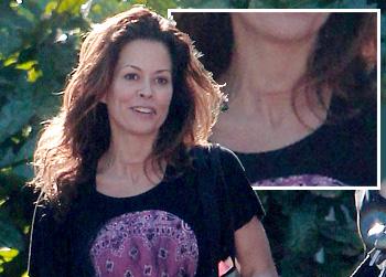 //brooke burke scar