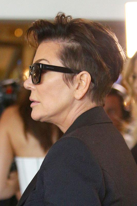 Kris Jenner Bald Spot