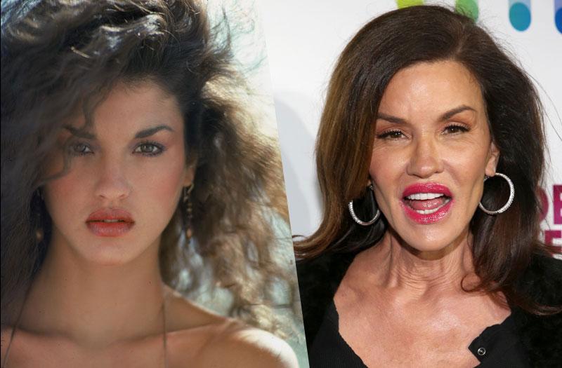 celebrity plastic surgery freaky faces