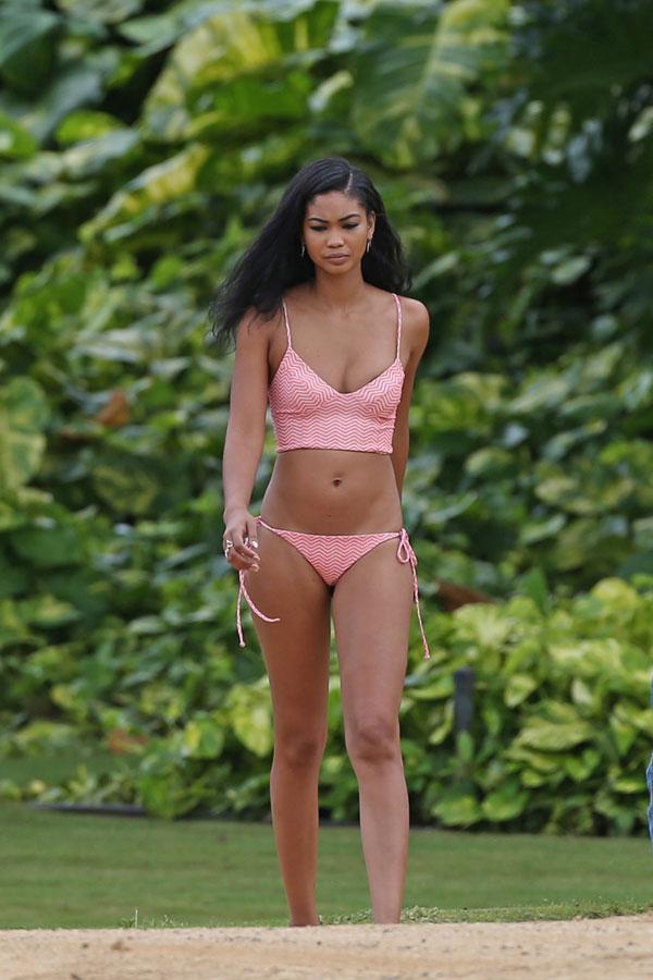 From Rash To Riches: Bikini Clad Chanel Iman Sports Scary Hives & Suffe...