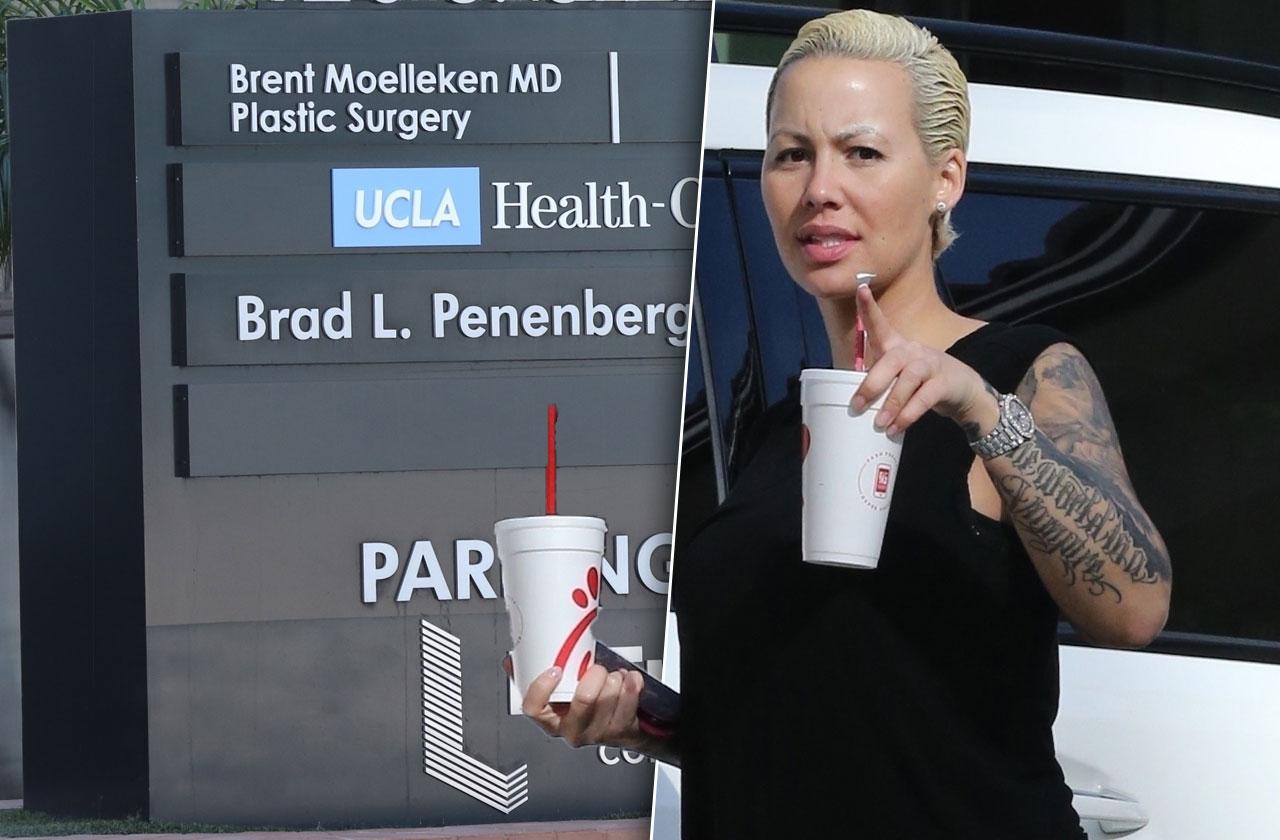 Amber Rose getting breast reduction surgery