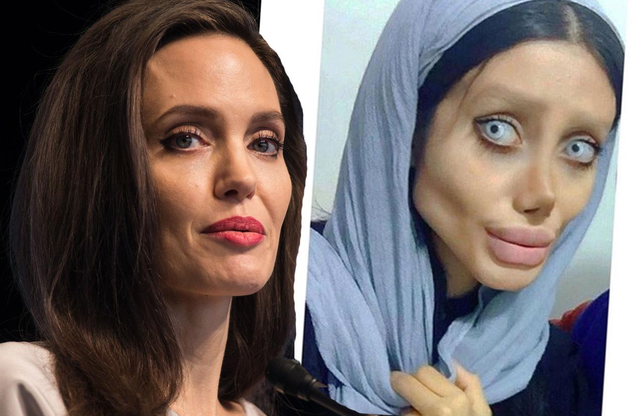 Angelina jolie deals plastic surgery