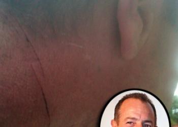 //fc_exc_michaellohannjuries_