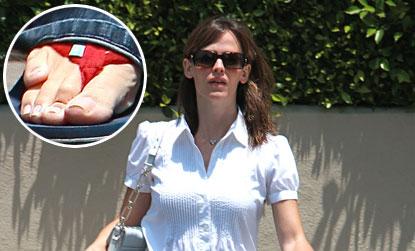 //jennifer garner celebritiy deformity