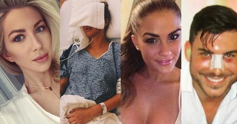 Vanderpump Rules Cast Plastic Surgery