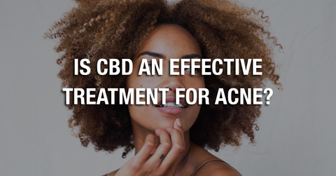 Is CBD An Effective Treatment For Acne?