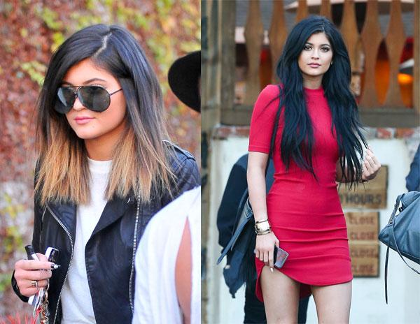 //kylie jenner plastic surgery top doctor estimates boob job face work extensions