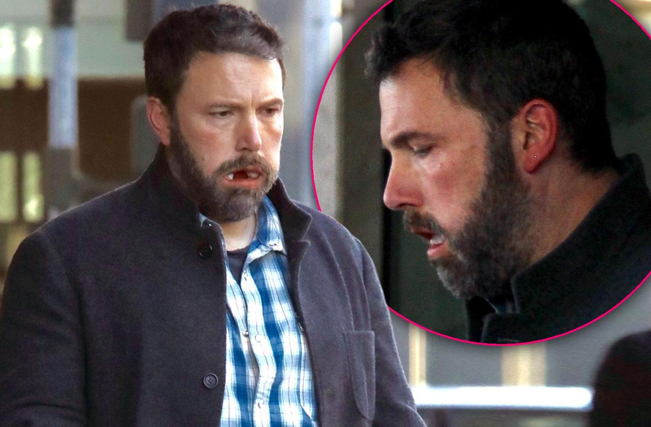 Ben Affleck Cotton Mouth Dental Surgery