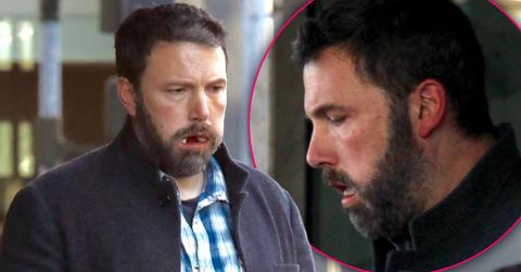 Ben Affleck Cotton Mouth Dental Surgery