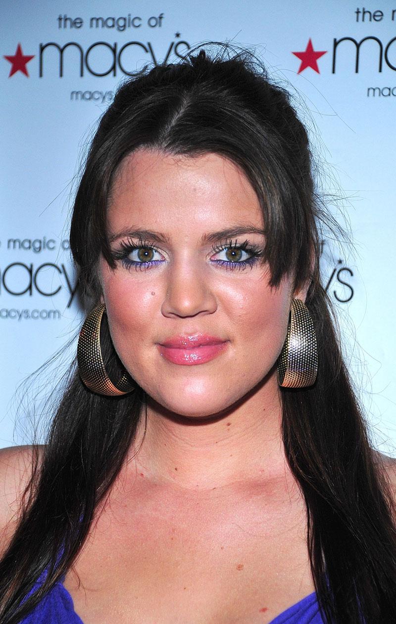 Khloe Kardashian Plastic Surgery Lips Fillers Selfie Botched Pics