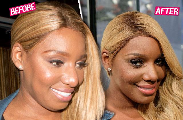 nene leakes nose job plastic surgery RHOA Exposed Photos