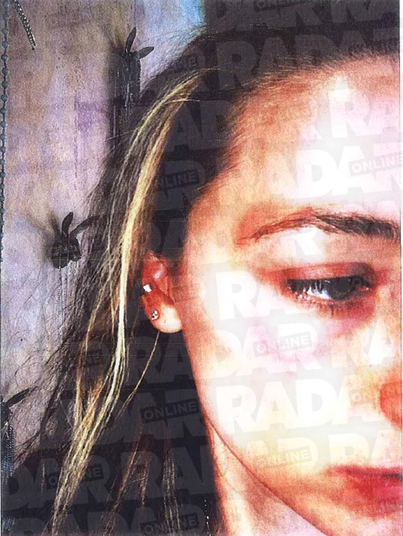 Amber Heard Johnny Depp Abuse Claims Photo Damage