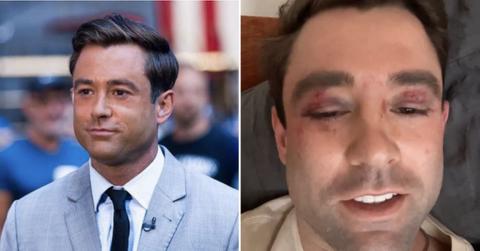 Fox News Weatherman Adam Klotz Attacked By Teenagers On NYC Subway