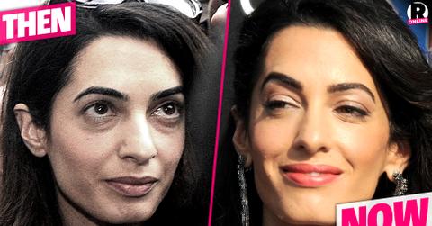 Plastic Is Perfect! Amal Clooney's Shocking New Face Is From Secret