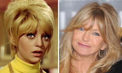 //goldie hawn senior surgery