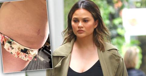 Chrissy Teigen Mom Bod Stretch Marks