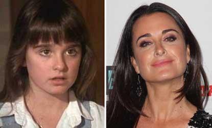 //kyle richards child star plastic surgery