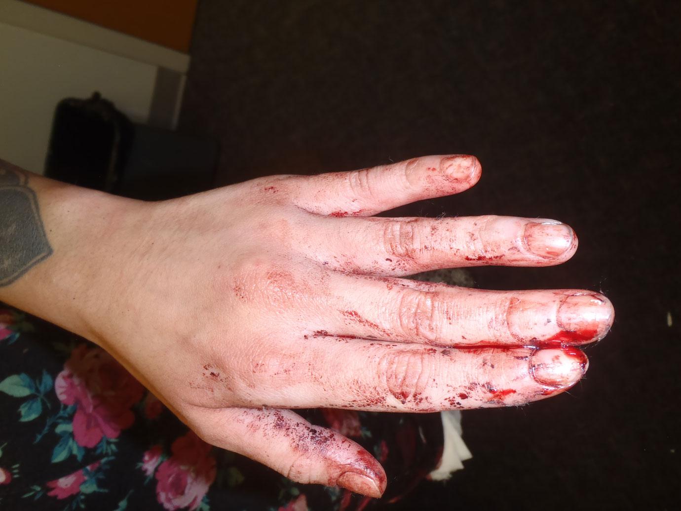 //woman stabbed boyfriend samurai sword bloody photos