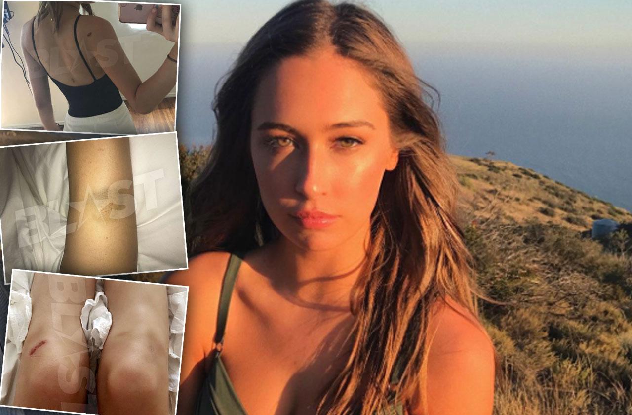 Ryan Phillippe Abuse Elsie Hewitt Lawsuit