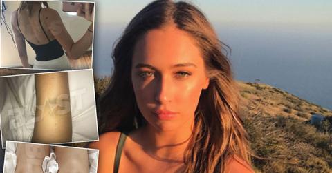 Ryan Phillippe Abuse Elsie Hewitt Lawsuit