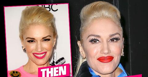 Gwen Stefani Plastic Surgery