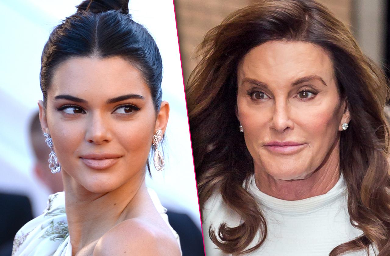 caitlyn jenner botox bonding kendall jenner plastic surgery