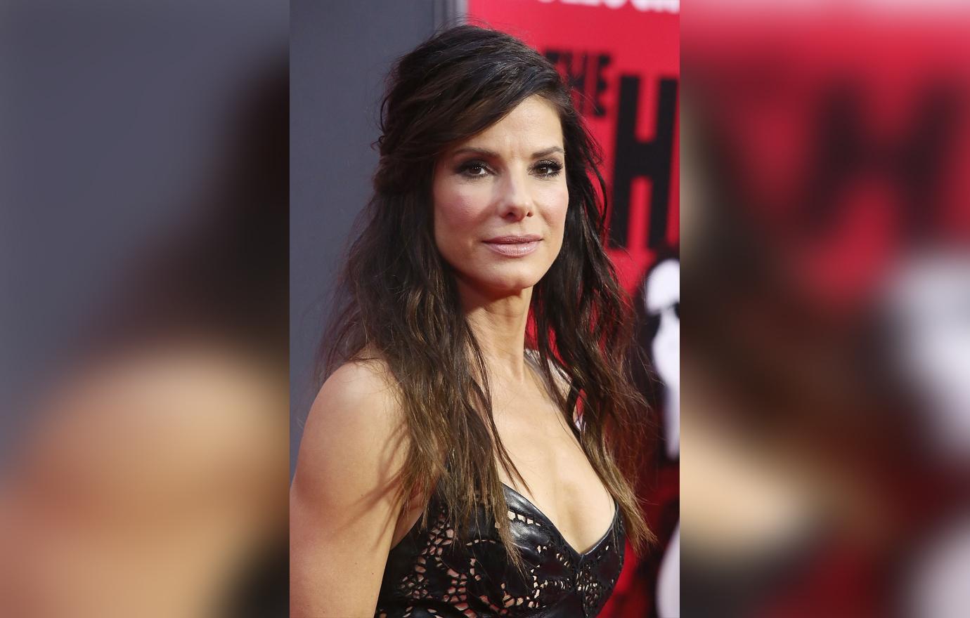 Sandra Bullock Plastic Surgery