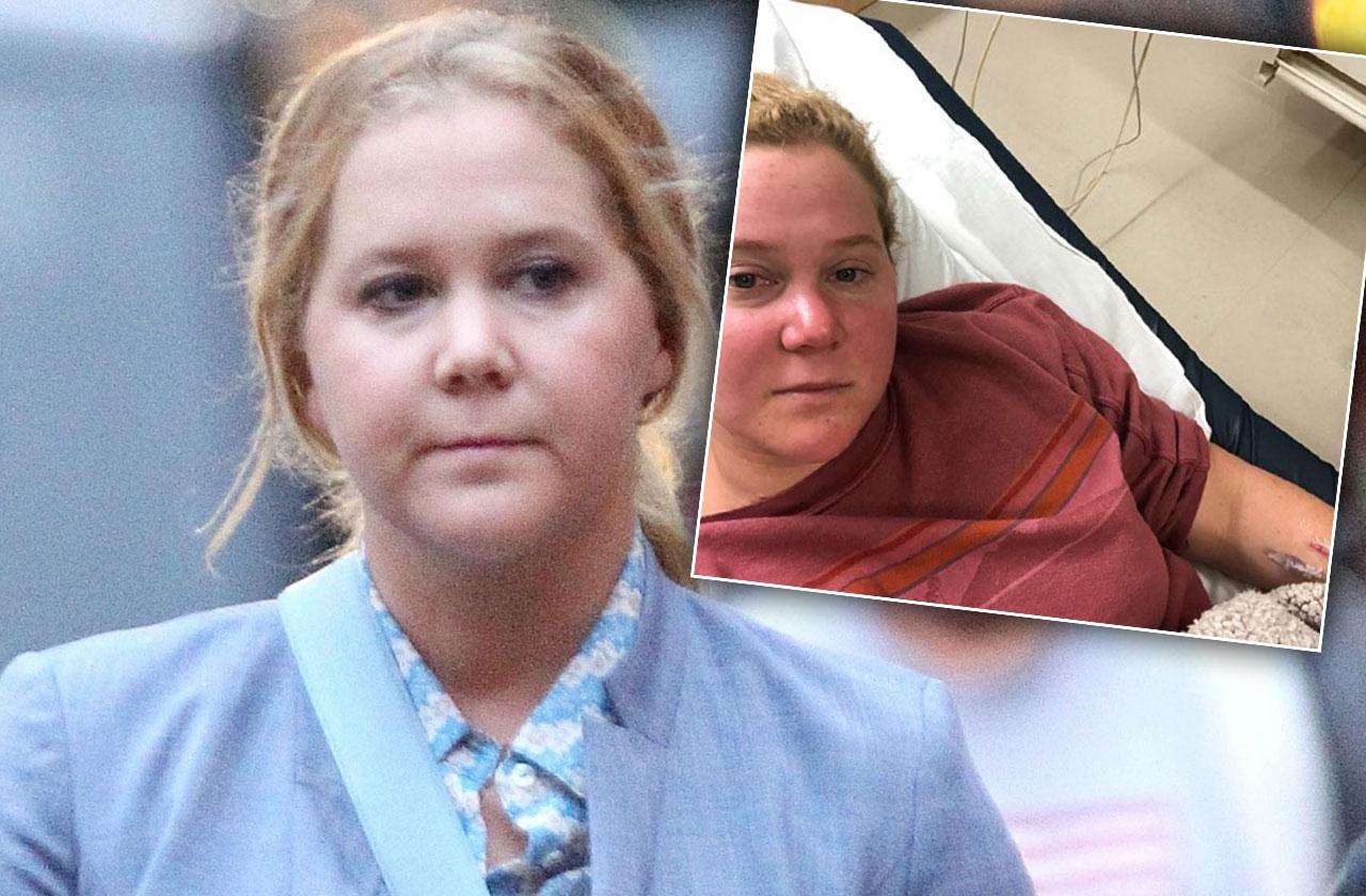 //Amy Schumer Hospitalized Kidney Infection pp