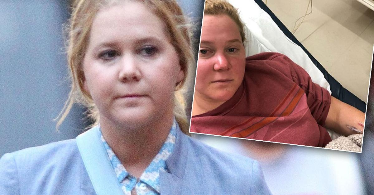 Amy Schumer Hospitalized For ‘Horrible’ Kidney Infection