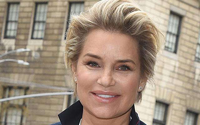 Yolanda Hadid Before After No Botox Plastic Surgery