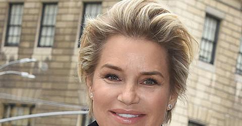 Yolanda Hadid Before After No Botox Plastic Surgery