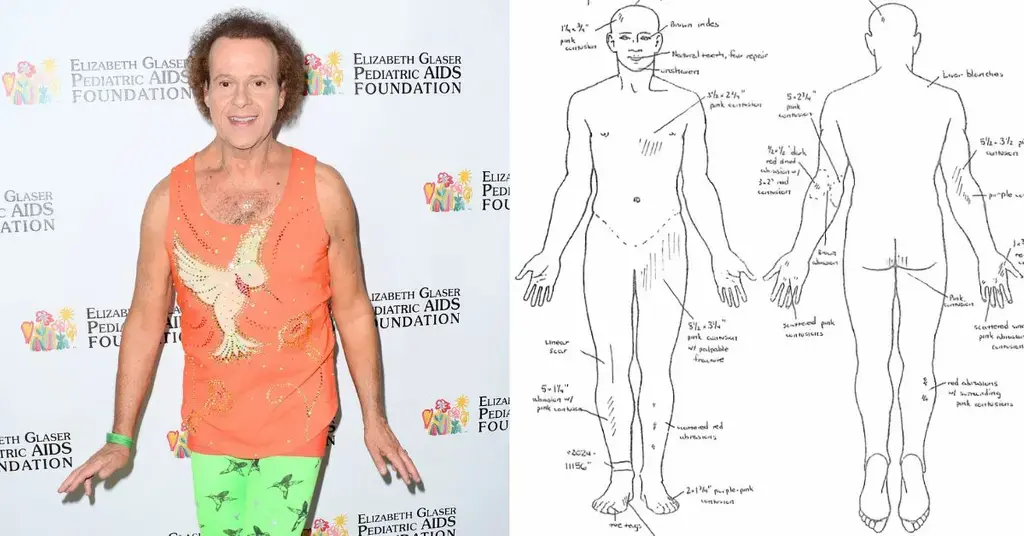 richard simmons autopsy corpse riddled abrasions cause death mystery